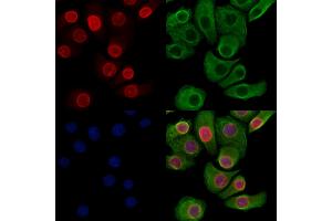 Phospho-Lamin A/C (Ser390) Antibody staining Hela cells(heat shock treatment) by IF/ICC.