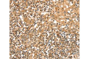 Immunohistochemistry (IHC) image for anti-Solute Carrier Family 8 (Sodium/calcium Exchanger), Member 3 (SLC8A3) antibody (ABIN2427255) (SLC8A3 anticorps)