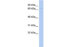 WB Suggested Anti-WDPCP Antibody Titration: 0. (WDPCP anticorps  (N-Term))