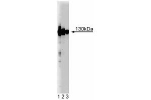 Western blot analysis of EphA4 on rat brain lysate. (EPH Receptor A4 anticorps  (AA 279-472))
