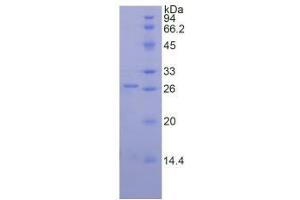 SDS-PAGE analysis of Mouse Proteinase 3 Protein.