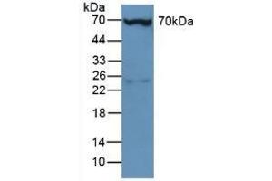 Detection of PLS3 in Mouse Liver Tissue using Polyclonal Antibody to Plastin 3 (PLS3) (Plastin 3 anticorps  (AA 5-251))