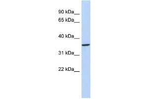 WB Suggested Anti-PITX3 Antibody Titration:  0. (PITX3 anticorps  (N-Term))