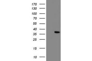 Western Blotting (WB) image for anti-Nuclear Receptor Interacting Protein 3 (NRIP3) antibody (ABIN1499831) (NRIP3 anticorps)
