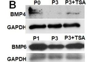 TSA rescues BMP expression in SKPs. (BMP4 anticorps)