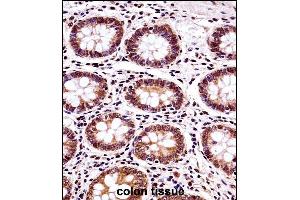 BANF1 Antibody (Center) ((ABIN657992 and ABIN2846938))immunohistochemistry analysis in formalin fixed and paraffin embedded human colon tissue followed by peroxidase conjugation of the secondary antibody and DAB staining.