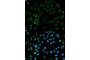 Immunofluorescence analysis of MCF-7 cells using TFPI antibody. (TFPI anticorps)