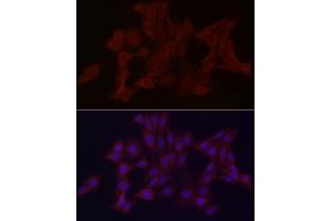 Immunofluorescence analysis of PC-12 cells using WDR45 Rabbit pAb (ABIN6133064, ABIN6150194, ABIN6150195 and ABIN6223490) at dilution of 1:100 (40x lens). (WDR45 anticorps  (AA 1-360))