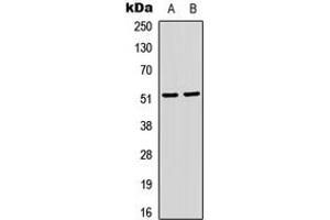 Western blot analysis of SRF (pS103) expression in HeLa (A), Jurkat (B) whole cell lysates. (SRF anticorps  (pSer103))