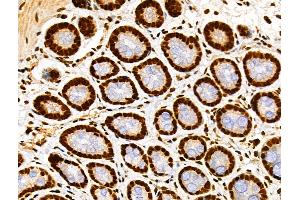 ABIN7093238 and ABIN7097250 at 1/100 staining Rat stomach tissue by IHC-P. (H2AFX anticorps  (acLys9))