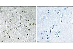 Immunohistochemistry (IHC) image for anti-Transcription Factor E3 (TFE3) (AA 101-150) antibody (ABIN2889417) (TFE3 anticorps  (AA 101-150))