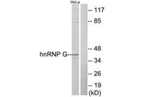 Western Blotting (WB) image for anti-RNA Binding Motif Protein, X-Linked (RBMX) (AA 6-55) antibody (ABIN2889468) (RBMX anticorps  (AA 6-55))