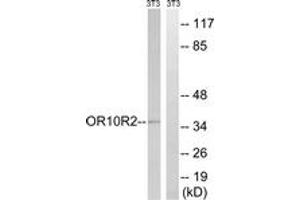 Western blot analysis of extracts from NIH-3T3 cells, using MAGEA5 Antibody. (MAGEA5 anticorps  (AA 68-117))