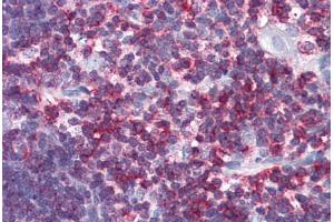 Human Thymus (formalin-fixed, paraffin-embedded) stained with CD45 antibody ABIN337379 at 10 ug/ml followed by biotinylated goat anti-rabbit IgG secondary antibody ABIN481713, alkaline phosphatase-streptavidin and chromogen. (CD45 anticorps  (C-Term))