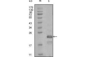 Western blot analysis using HAND1 mouse mAb against truncated Trx-HAND1 recombinant protein (1). (HAND1 anticorps  (AA 90-190))