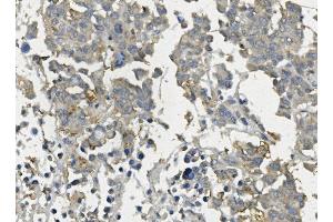 IHC analysis of Claudin 3/CLDN3 using anti-Claudin 3/CLDN3 antibody (ABIN7602816). (Claudin 3 anticorps  (C-Term))