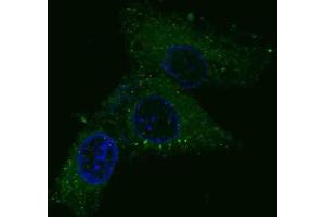 Immunofluorescence (IF) image for anti-Met Proto-Oncogene (MET) antibody (ABIN2995275) (c-MET anticorps)