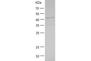 Western Blotting (WB) image for GA Repeat Binding Protein, beta 1 (GABPB1) (AA 1-395) protein (His-IF2DI Tag) (ABIN7123031)