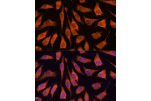 Immunofluorescence analysis of L929 cells using GOLPH3 antibody (ABIN6131711, ABIN6141272, ABIN6141273 and ABIN6216996) at dilution of 1:100.