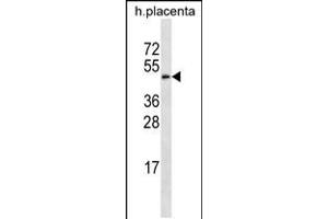 Western blot analysis in human placenta tissue lysates (35ug/lane). (GAL3ST4 anticorps  (AA 201-230))