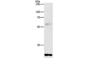 Western Blot analysis of Mouse lung tissue using FGF2 Polyclonal Antibody at dilution of 1:1000 (FGF2 anticorps)