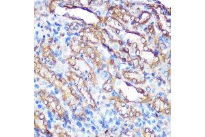 Immunohistochemistry of paraffin-embedded rat kidney using Bcl-XL Rabbit pAb (ABIN3020685, ABIN3020686, ABIN1512625 and ABIN6213668) at dilution of 1:100 (40x lens).