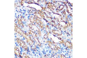 Immunohistochemistry of paraffin-embedded rat kidney using Bcl-XL Rabbit pAb (ABIN3020685, ABIN3020686, ABIN1512625 and ABIN6213668) at dilution of 1:100 (40x lens). (BCL2L1 anticorps  (AA 1-120))