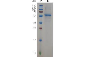 Human KRAS Protein, hFc Tag on SDS-PAGE under reducing condition.