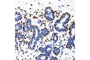 Immunohistochemistry of paraffin-embedded Human mammary gland using Histone H3 antibody at dilution of 1:100 (x400 lens). (Histone 3 anticorps  (C-Term))