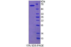 SDS-PAGE analysis of Rat TDP1 Protein. (TDP1 Protéine)