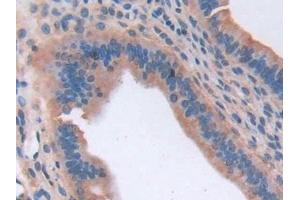 Detection of CD74 in Mouse Uterus Tissue using Polyclonal Antibody to Cluster Of Differentiation 74 (CD74)