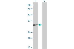 Western Blot analysis of HOXC4 expression in transfected 293T cell line by HOXC4 monoclonal antibody (M01), clone 1E9.