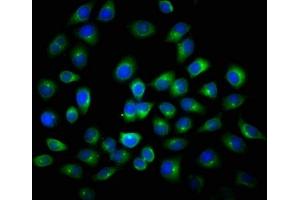 Immunofluorescence staining of A549 cells with ABIN7144072 at 1:116, counter-stained with DAPI. (ANAPC2 anticorps  (AA 1-230))