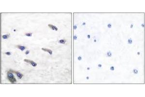 Immunohistochemistry analysis of paraffin-embedded human brain, using PDGF Receptor beta (Phospho-Tyr751) Antibody. (PDGFRB anticorps  (pTyr751))