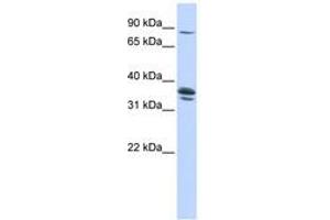 Image no. 1 for anti-Solute Carrier Organic Anion Transporter Family, Member 3A1 (SLCO3A1) (AA 360-409) antibody (ABIN6740849) (Solute Carrier Organic Anion Transporter Family, Member 3A1 (SLCO3A1) (AA 360-409) anticorps)