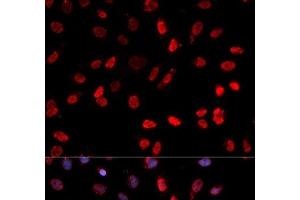 Immunofluorescence analysis of MCF-7 cells using Phospho-ATF2(T71) Polyclonal Antibody (ATF2 anticorps  (pThr71))
