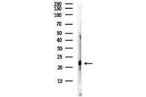 Western blot analysis of lysates from HUVEC cells, using NTS Antibody at 1/1000 dilution.