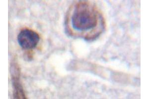 Immunohistochemistry analyzes of CaR antibody in paraffin-embedded human brain tissue. (CASR anticorps)