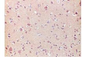 Immunohistochemistry (IHC) image for anti-Frataxin (FXN) antibody (ABIN781667)
