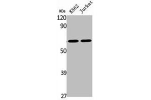 Western Blot analysis of K562 Jurkat cells using BOCT Polyclonal Antibody (SLC22A17 anticorps  (Internal Region))