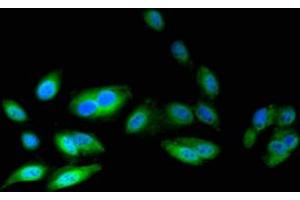 Immunofluorescent analysis of Hela cells using ABIN7145576 at dilution of 1:100 and Alexa Fluor 488-congugated AffiniPure Goat Anti-Rabbit IgG(H+L) (ATIC anticorps  (AA 301-592))
