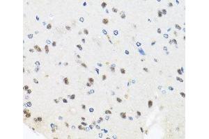 Immunohistochemistry of paraffin-embedded Rat brain using PRPF8 Polyclonal Antibody at dilution of 1:100 (40x lens).