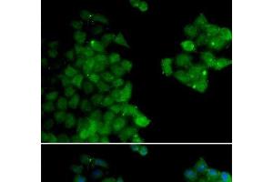 Immunofluorescence analysis of HeLa cells using PSMB10 Polyclonal Antibody (PSMB10 anticorps)