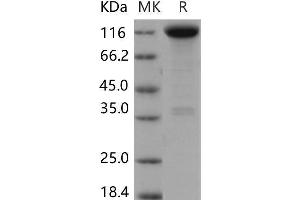 Western Blotting (WB) image for Neurotrophic Tyrosine Kinase, Receptor, Type 1 (NTRK1) (Active) protein (Fc Tag) (ABIN7320046)