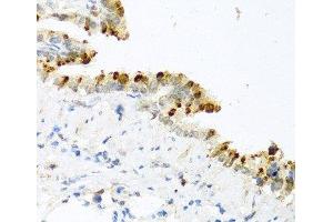 Immunohistochemistry of paraffin-embedded Mouse lung using BMP4 Polyclonal Antibody at dilution of 1:100 (40x lens). (BMP4 anticorps)