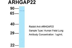 Host: Rabbit  Target Name: ARHGAP22  Sample Tissue: Human Fetal Lung  Antibody Dilution: 1. (ARHGAP22 anticorps  (C-Term))