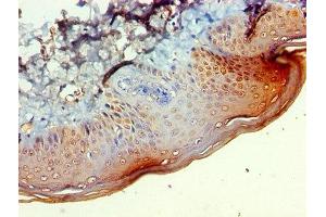 Immunohistochemistry of paraffin-embedded human skin tissue using ABIN7145746 at dilution of 1:100 (BCAT2 anticorps  (AA 28-392))