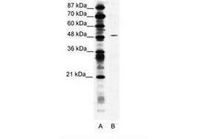 Image no. 1 for anti-Suppressor of Variegation 4-20 Homolog 1 (SUV420H1) (AA 763-812) antibody (ABIN203167) (SUV420H1 anticorps  (AA 763-812))