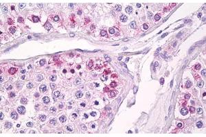 Anti-USP13 antibody IHC staining of human testis. (USP13 anticorps  (AA 500-550))