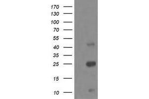 Image no. 3 for anti-Aldehyde Dehydrogenase 1 Family, Member A3 (ALDH1A3) (AA 1-100), (AA 413-512) antibody (ABIN1490537) (ALDH1A3 anticorps  (AA 1-100, AA 413-512))